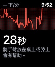 apple watch ecg