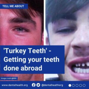 jack-finchman-turkey-teeth