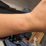 Google-Pixel-Watch-2-skin-irritation-5