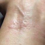 Pixel-Watch-2-band-causing-skin-irritation-4